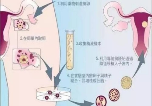 上海供精代生：死精症有哪些现象？死精症主要是这些原因引起的