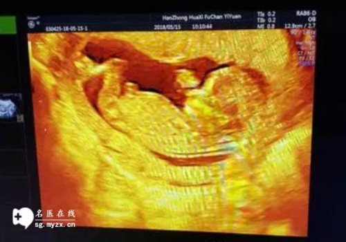 上海供卵试管：易孕体质的女性通常都有什么特征呢？