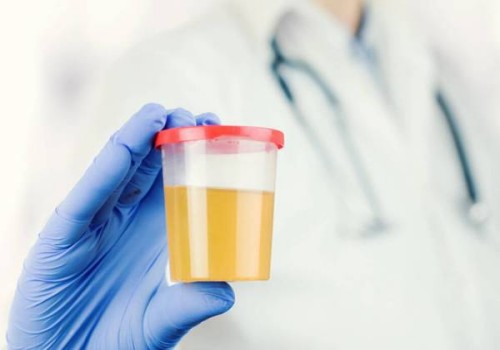 上海助孕机构：怎样从检查中判断胎儿是否患有地中海贫血？