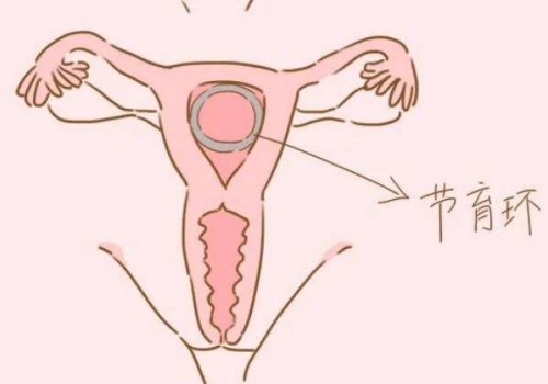 2022年上海试管婴儿政策最新解读：医保报销也有条件